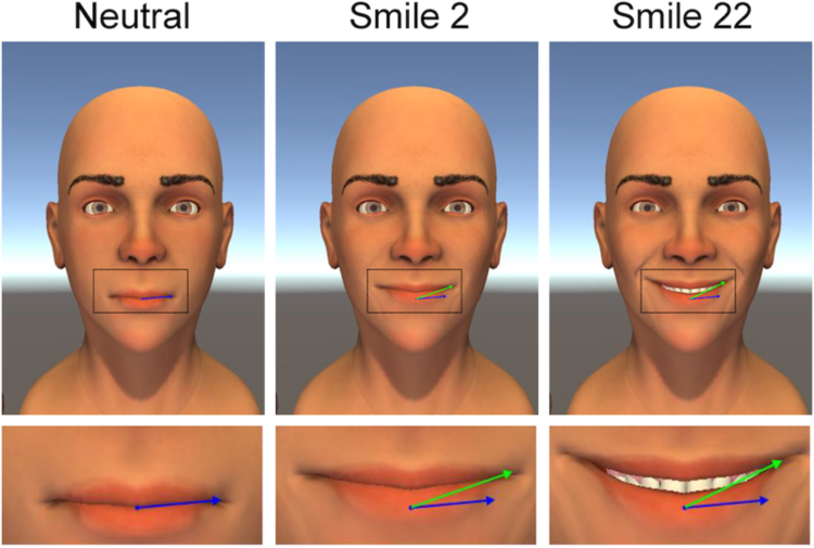 Real Clear Science: Study Reveals the Best and Worst Smiles - The