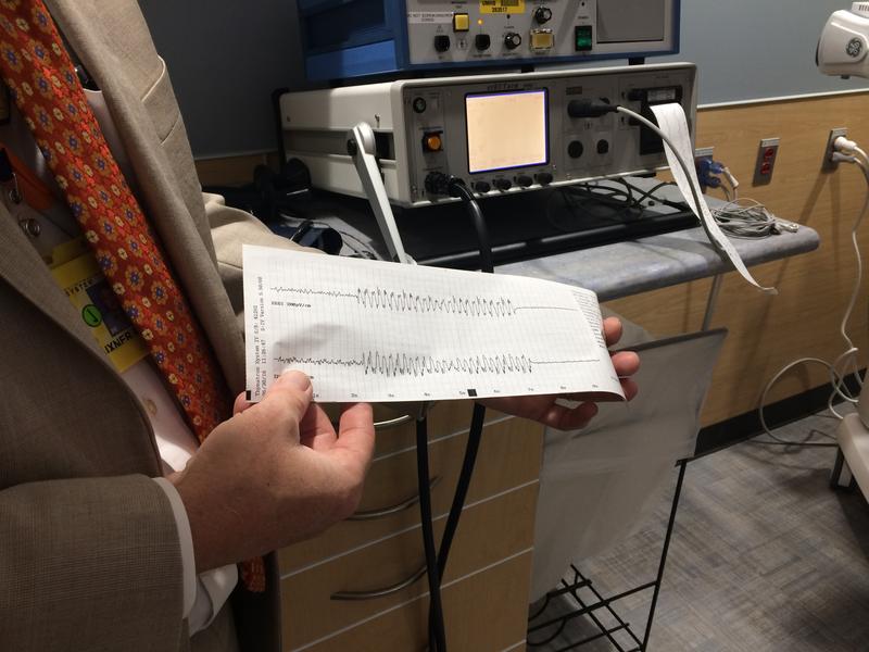 The Dangerous History of Electroconvulsive Therapy Video