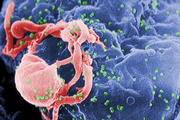 The Rare People Who Are Invulnerable to HIV