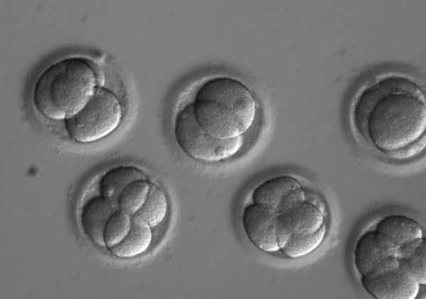 Unique From Day One: Pro-life Is Pro-Science