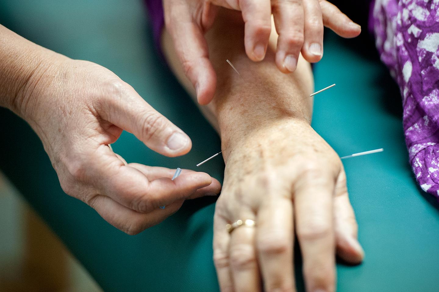 Acupuncture and the Placebo Problem RealClearScience