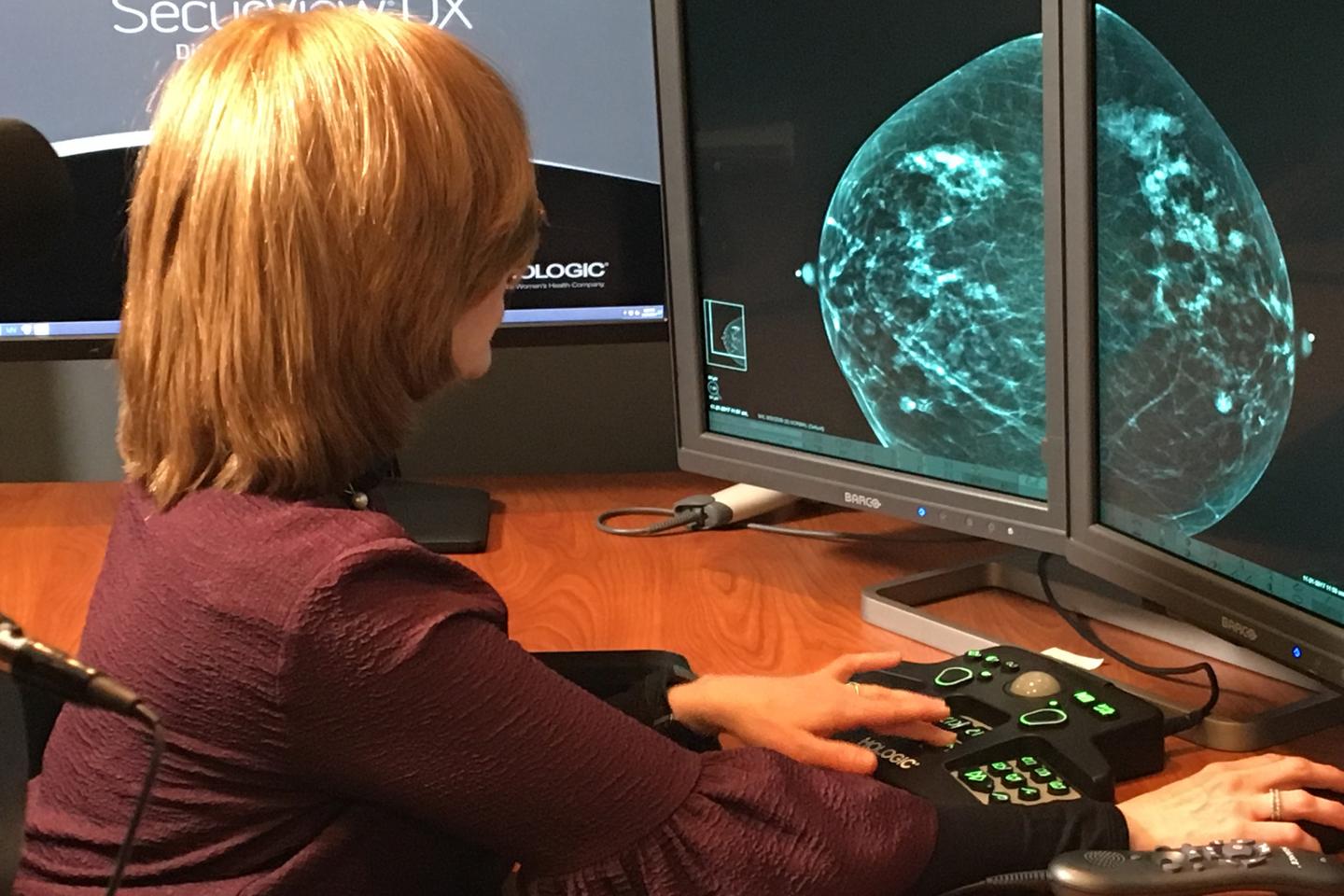 The High Cost of Finding Breast Cancer Too Late