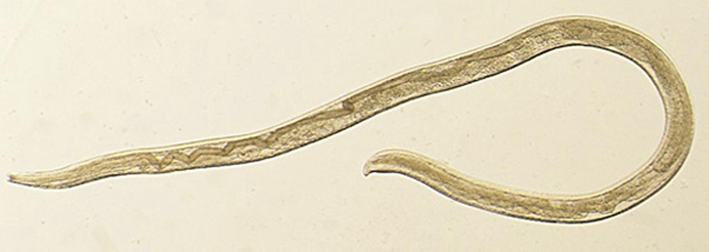 Save the Parasites? They're Endangered, Too | RealClearScience