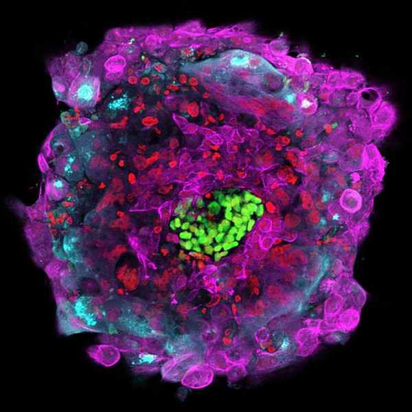 Gene-Edited Babies Closer to Reality. Ethics Need to Catch Up