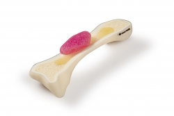 Researchers Develop Ultra-Thin 'Computer on the Bone'
