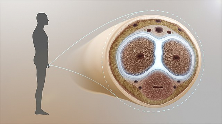 penile fracture treatment cost