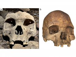 Medieval Skulls in Gabon Missing Front Teeth