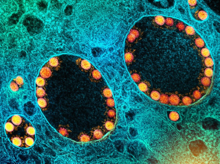Coronavirus Continues to Confound Scientists
