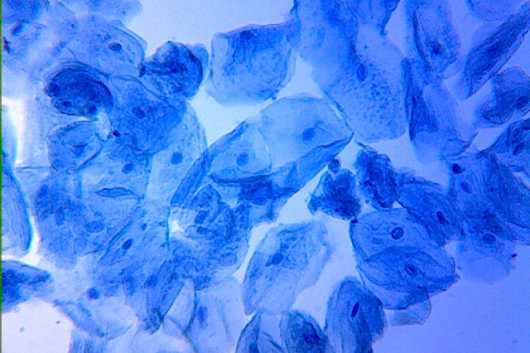 An Entirely New Target for Fighting Senescence