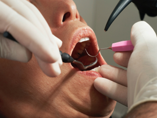 Covid-era Dental Coverage Gone. Low-income Americans at risk.