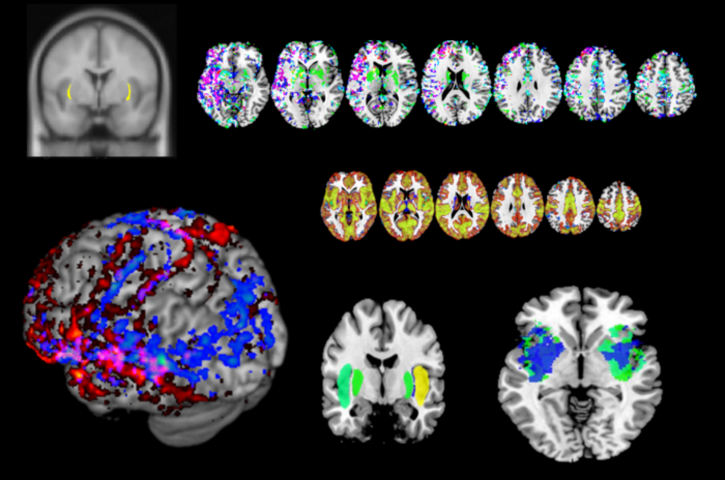 Five Ways the Brain Can Age | RealClearScience