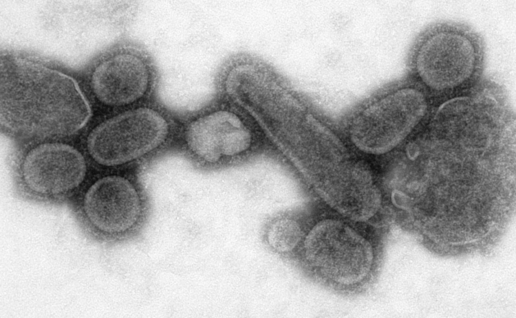 Did Horses Trigger the 1918 Flu Pandemic?