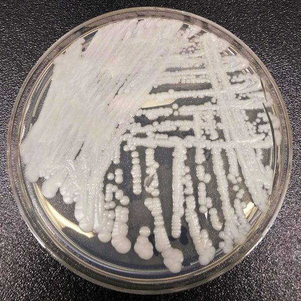 Candida Auris: Scary and Difficult to Treat