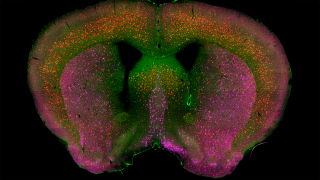 Researchers Turn to CRISPR Treat Alzheimer's