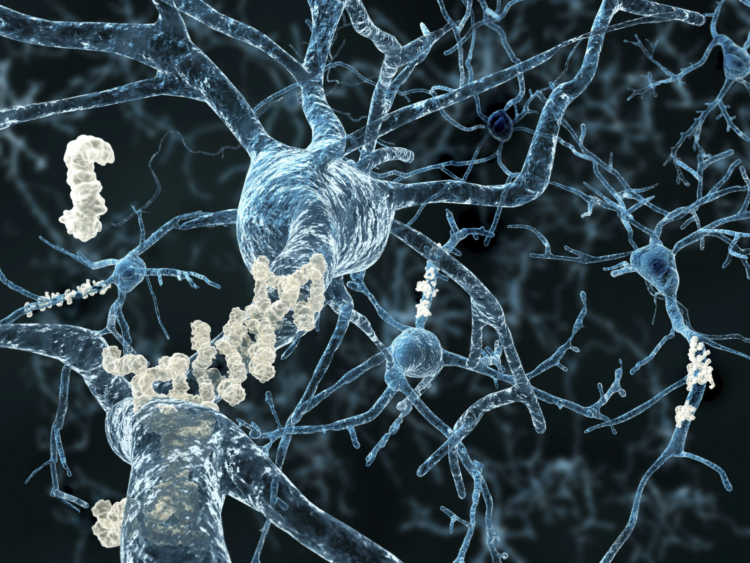 Alzheimer's and the Amyloid Mafia