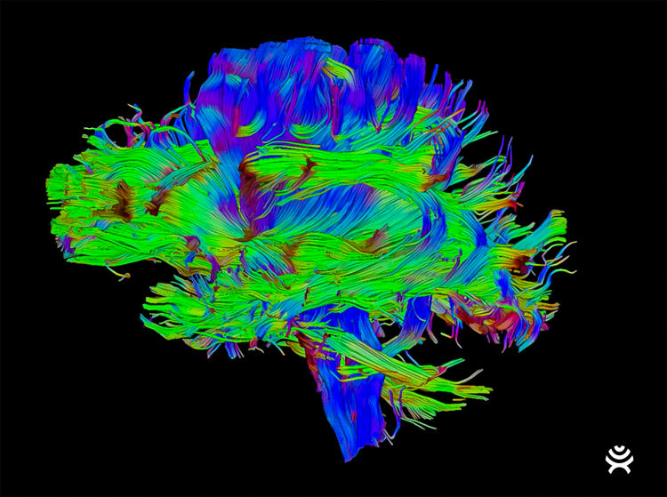 Strange Pattern Could Explain Origins of Brain Cancer