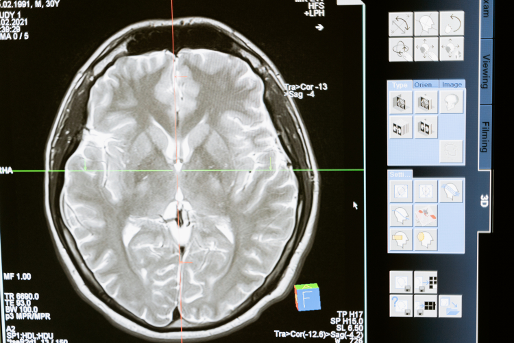 Hidden Gateways Allow the Brain to Clear Waste