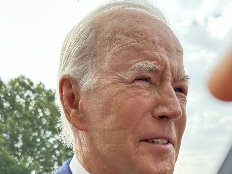 FOX News Marks On President Biden's Face This Morning Were From CPAP