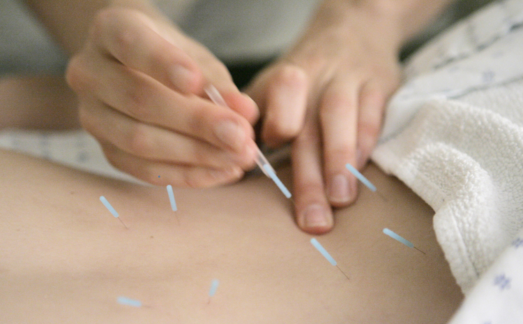 Time to Stop Publishing Chinese Acupuncture Research?