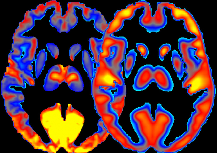 Why Similar Genes Can Lead to Very Different Brains