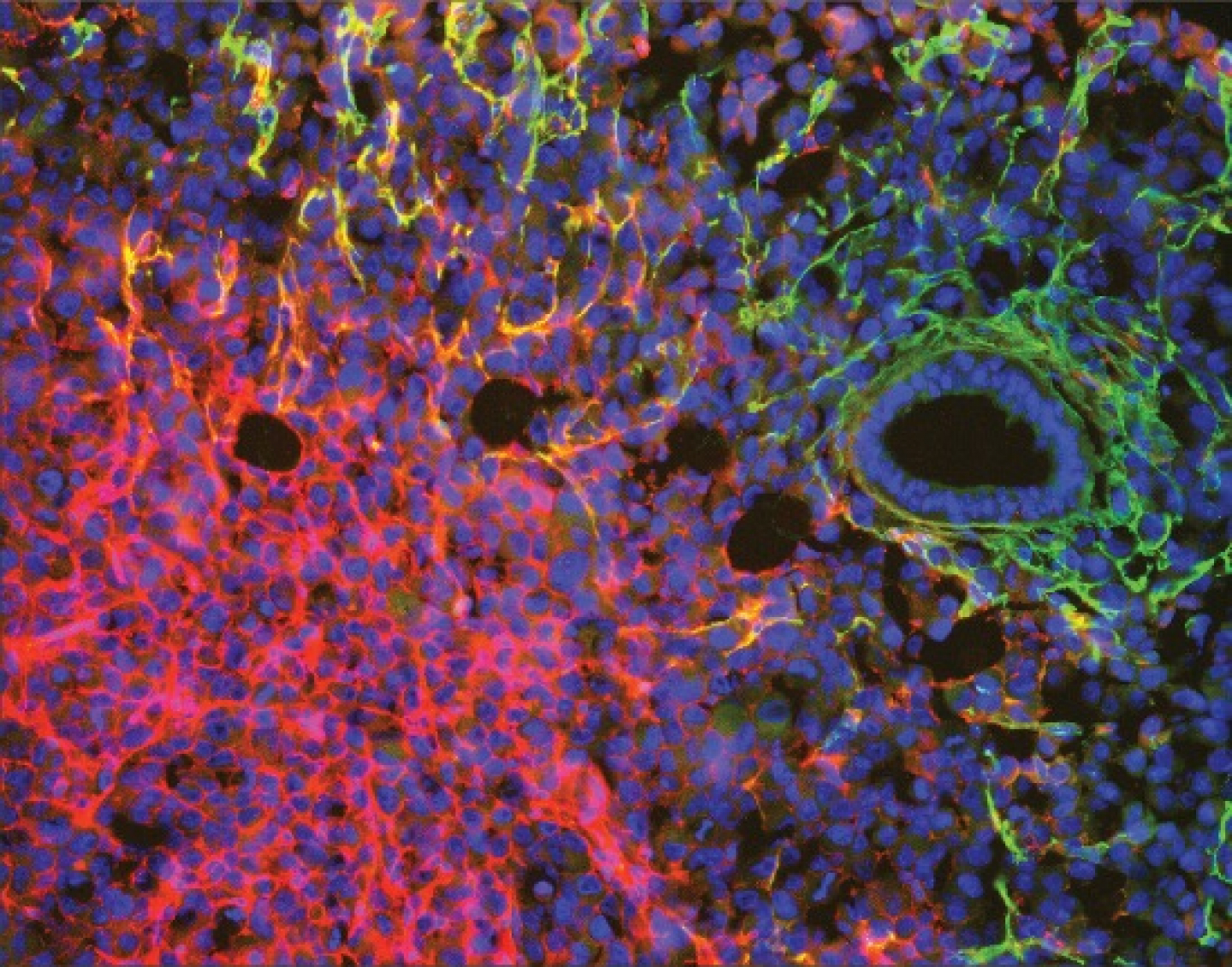 What Happens To Cancer Cells When They Die RealClearScience what-happens-to-cancer-cells-when-they-die-realclearscience