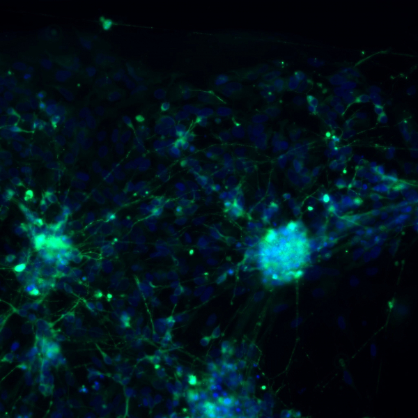 Depression Stalls Formation of New Brain Cells