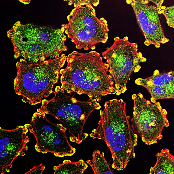 How the Body Ages, Cell by Cell
