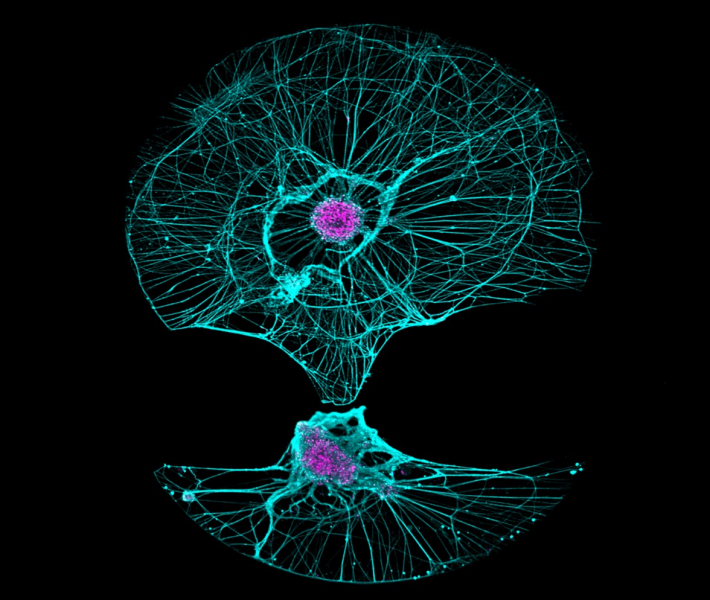 Researchers Observe 'Longevity Gene' at Work in the Brain