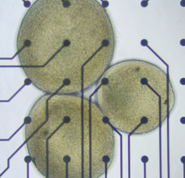 'Mini Brains' Kept Alive for Years Seem to Age Like Real Brains