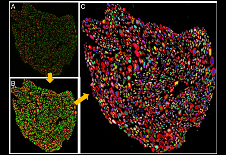 Scientists Closer to Understanding Power of the Vagus Nerve