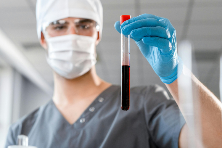 A Low-Cost Blood Test to Detect Early Alzheimer's
