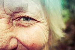 Thyroid Disease or Normal Aging?