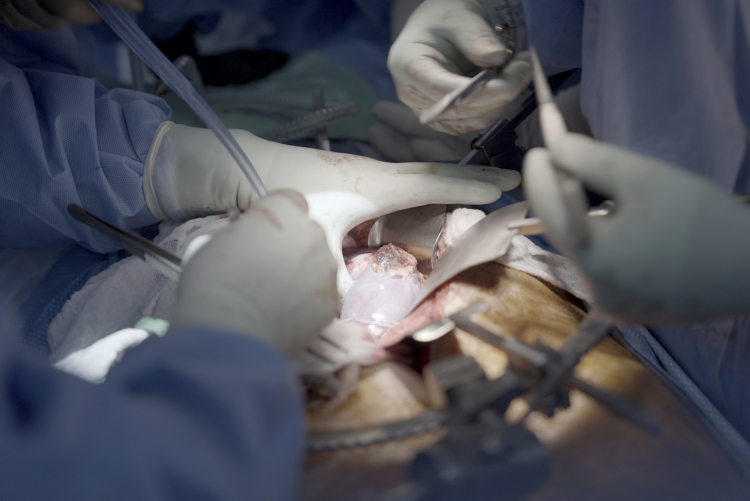 Is Xenotransplantation About to Become the Norm?