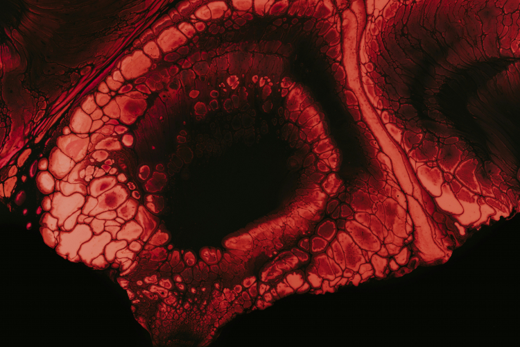 Could Myocardial Infarction Be an Infectious Disease?