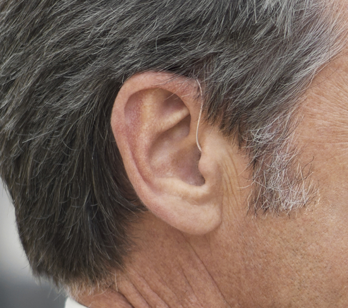 The Misunderstood Link Between Hearing Loss and Dementia