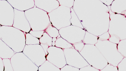 Our Fat Tissue May 'Remember' Obesity