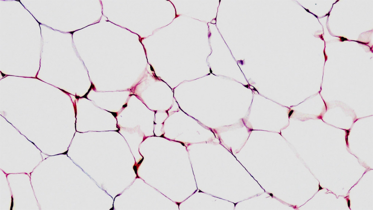 Scientists Discover Pathway That Activates Brown Fat