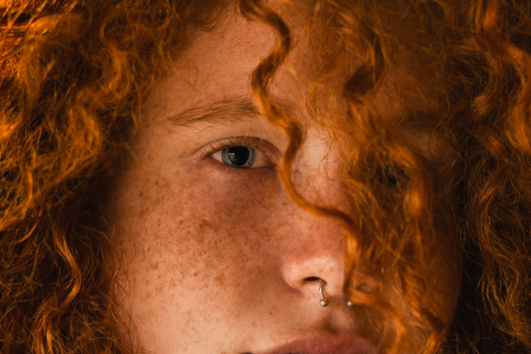 The Gene Tied to Red Hair Also Messes With Pain
