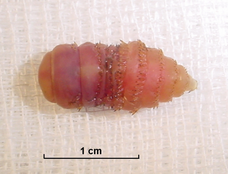A Woman Sneezed Out Botfly Larvae