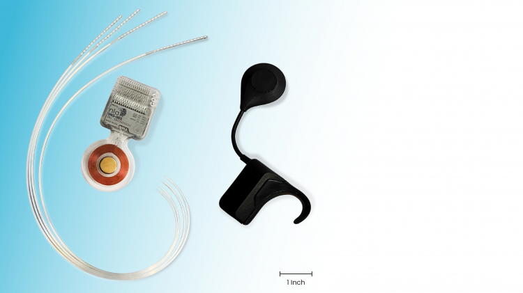 What It's Like to Live With an Experimental Brain Implant