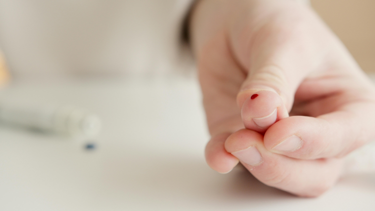 At-Home Fingerprick Test May Spot Alzheimer's