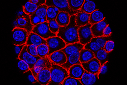 The Most Hopeful Cancer News in Years