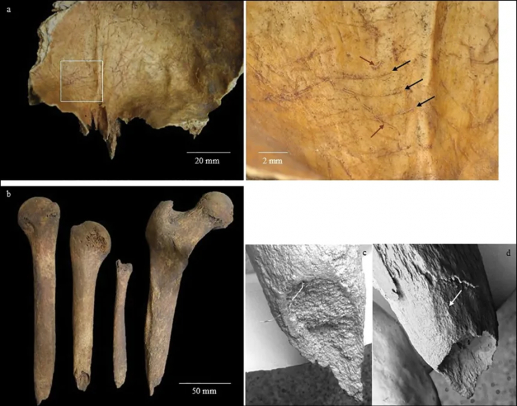 Iron Age Woman Likely Had Her Brain Scooped Out