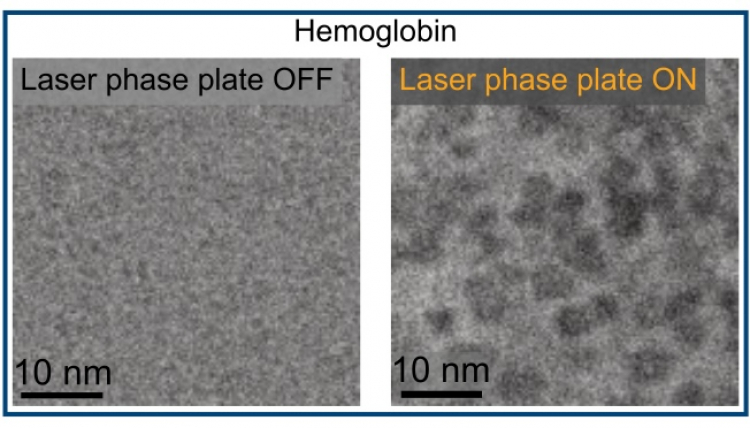 Breakthrough in Electron Microscopy Delivers Sharper Images