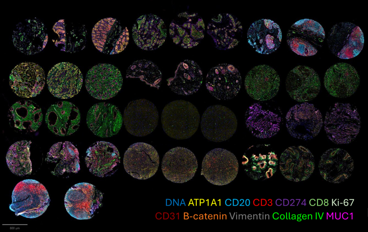 A New Path to Preventing Cancer