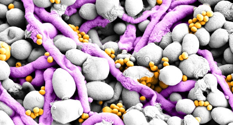 Copper Economy Helps Fungi and Bacteria Build Biofilms