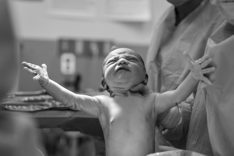 Childbirth Is Not Uniquely Difficult for Humans