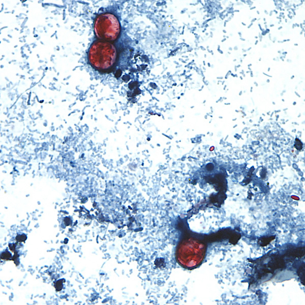 Why We Don't Know the Food Causing the U.S. Parasite Outbreak