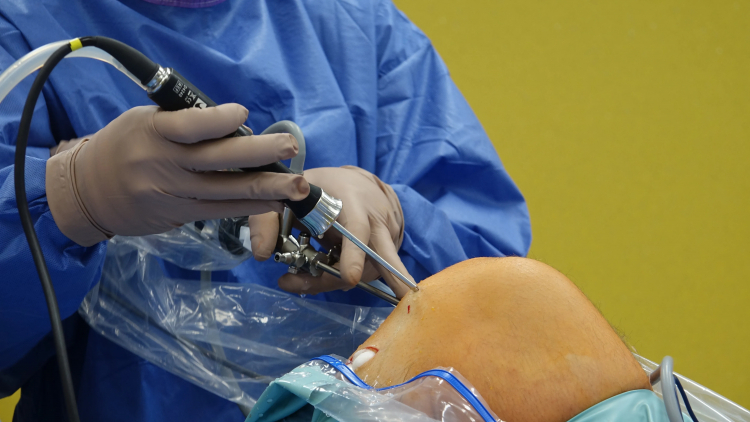 Arthroscopic Knee Surgery Does More Harm Than Good