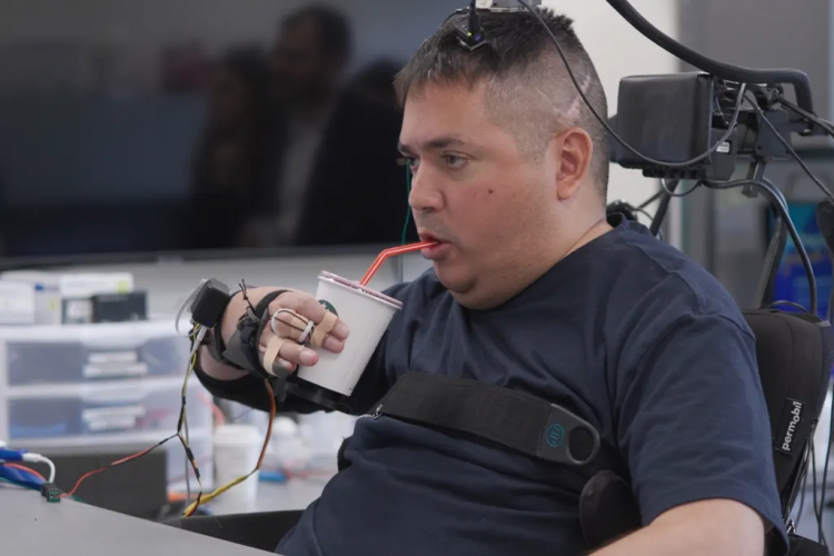 Paralyzed Man Regained Hand Movement After Implant